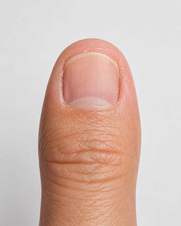 Nail disorder care after result